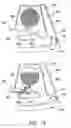 Fig. 15 - Blood micro-separator