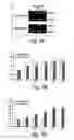 Fig. 07 - Methods and compositions for protection against thrombolysis associated reperfusion injury