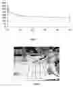 Fig. 03 - Quantification of botulinum toxin
