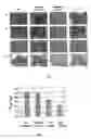 Fig. 02 - Neoplasm specific antibodies and uses thereof