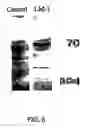 Fig. 06 - Neoplasm specific antibodies and uses thereof