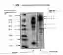 Fig. 02 - Antibody-serum protein hybrids