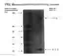 Fig. 09 - Antibody-serum protein hybrids