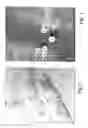 Fig. 02 - Bioartificial implant and its use and method of reducing the risk for formation of connective tissue after implantation