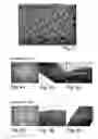Fig. 03 - Bioartificial implant and its use and method of reducing the risk for formation of connective tissue after implantation