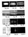 Fig. 08 - Bioartificial implant and its use and method of reducing the risk for formation of connective tissue after implantation