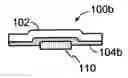 Fig. 01 - Self-adhering lesion formation apparatus and methods