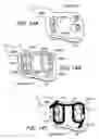 Fig. 05 - Self-adhering lesion formation apparatus and methods