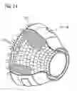 Fig. 07 - Process for applying material to a component, a fiber and a fiber mat