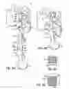 Fig. 03 - Orthodontic brackets and appliances and methods of making and using orthodontic brackets
