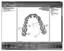 Fig. 01 - Method and system for finding tooth features on a virtual three-dimensional model