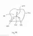 Fig. 09 - Method and system for finding tooth features on a virtual three-dimensional model