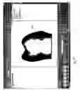 Fig. 28 - Method and system for finding tooth features on a virtual three-dimensional model