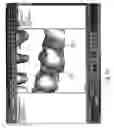 Fig. 35 - Method and system for finding tooth features on a virtual three-dimensional model