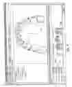 Fig. 05 - Method and apparatus for digitally evaluating insertion quality of customized orthodontic arch wire