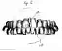 Fig. 03 - Method and system for measuring tooth displacements on a virtual three-dimensional model