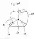 Fig. 04 - Method and system for measuring tooth displacements on a virtual three-dimensional model