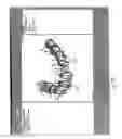 Fig. 05 - Method and system for measuring tooth displacements on a virtual three-dimensional model