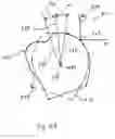 Fig. 13 - Method and system for measuring tooth displacements on a virtual three-dimensional model