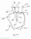 Fig. 15 - Method and system for measuring tooth displacements on a virtual three-dimensional model