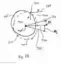 Fig. 17 - Method and system for measuring tooth displacements on a virtual three-dimensional model