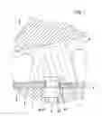 Fig. 02 - Equalizing device and method of measurement in teeth restorations