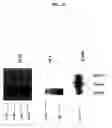 Fig. 22 - ELF3 gene compositions and methods