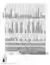 Fig. 48 - Methods and systems for diagnosis of non-central nervous system (cns) diseases in cns samples