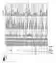 Fig. 95 - Methods and systems for diagnosis of non-central nervous system (cns) diseases in cns samples