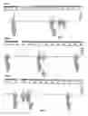 Fig. 04 - Detection of aneuploidy