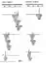 Fig. 05 - Detection of aneuploidy