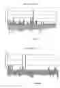 Fig. 05 - Novel nucleotide and amino acid sequences, and assays and methods of use thereof for diagnosis of colon cancer