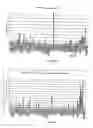 Fig. 16 - Novel nucleotide and amino acid sequences, and assays and methods of use thereof for diagnosis of colon cancer