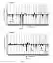 Fig. 02 - Markers of DNA copy number alteration for improved prognostication in prostate cancer