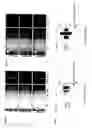 Fig. 03 - Modified trafficking patterns for arrestin and G-protein-coupled receptors via arrestin-ubiquitin chimera