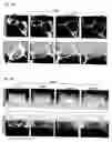 Fig. 06 - Modified trafficking patterns for arrestin and G-protein-coupled receptors via arrestin-ubiquitin chimera