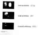 Fig. 05 - Recombinant herpes viruses for preparing recombinant adeno-associated viruses