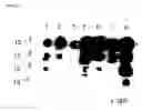 Fig. 07 - Recombinant herpes viruses for preparing recombinant adeno-associated viruses