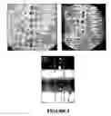Fig. 05 - Method of mass spectrometric analysis from closely packed microspots by their simultaneous laser irradiation