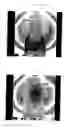 Fig. 05 - Electromagnetic wave shielding knitted material and electromagnetic wave shielding garment
