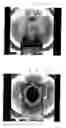 Fig. 06 - Electromagnetic wave shielding knitted material and electromagnetic wave shielding garment