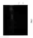 Fig. 04 - Composite ePTFE/textile prosthesis