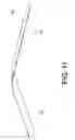 Fig. 12 - Composite ePTFE/textile prosthesis