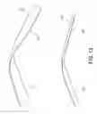 Fig. 14 - Composite ePTFE/textile prosthesis