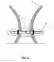 Fig. 05 - Method and apparatus for enhancing a bustline
