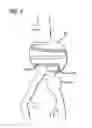 Fig. 04 - Methods and Devices for Contributing to the Treatment of Aneurysms