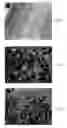 Fig. 14 - Compounds and Methods for Promoting Angiogenesis
