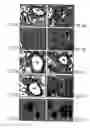 Fig. 04 - Methods for evaluating genetic susceptibility and therapy for chronic inflammatory diseases