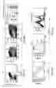 Fig. 05 - Methods for evaluating genetic susceptibility and therapy for chronic inflammatory diseases