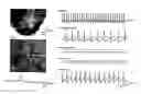 Fig. 01 - Methods and compositions for modulating calcium channels